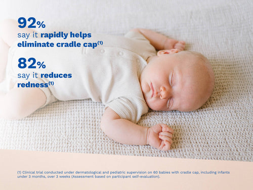 Cradle cap cream